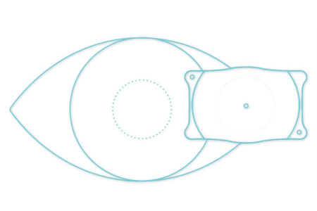 做ICL晶體可以報什么兵種呢？